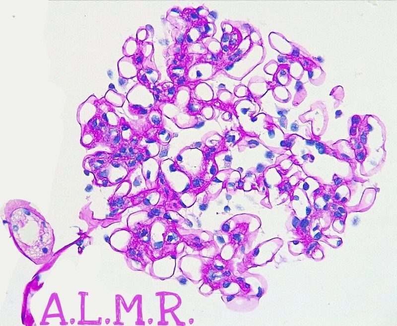 Glomérulo renal, tinción PAS