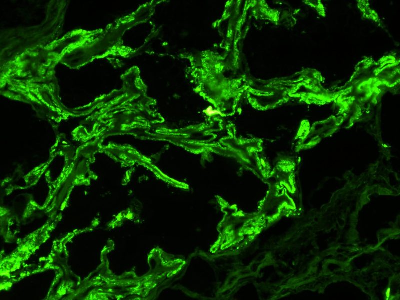 Inmunofluorescencia renal