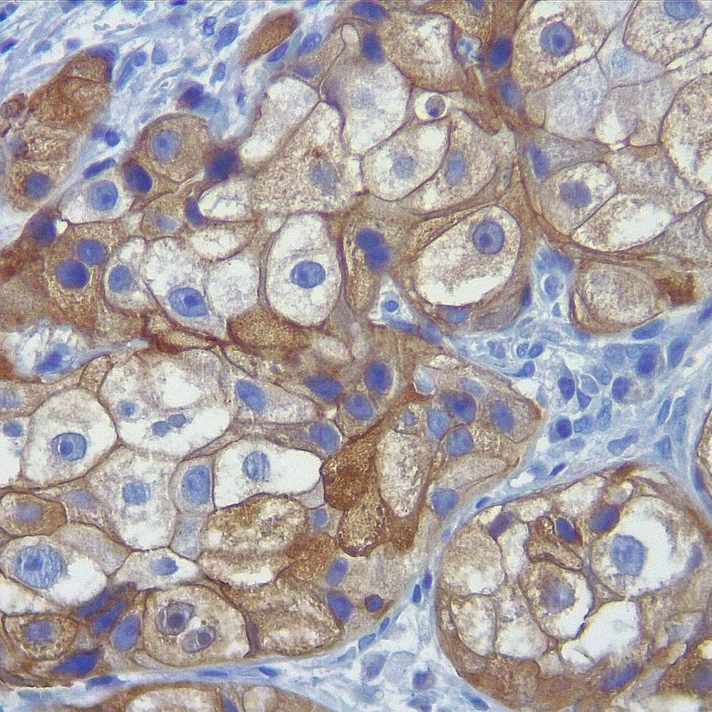 Inmunohistoquímica