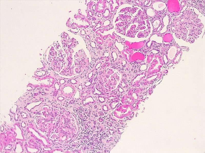 Panorámica de biopsia renal, tinción H&E